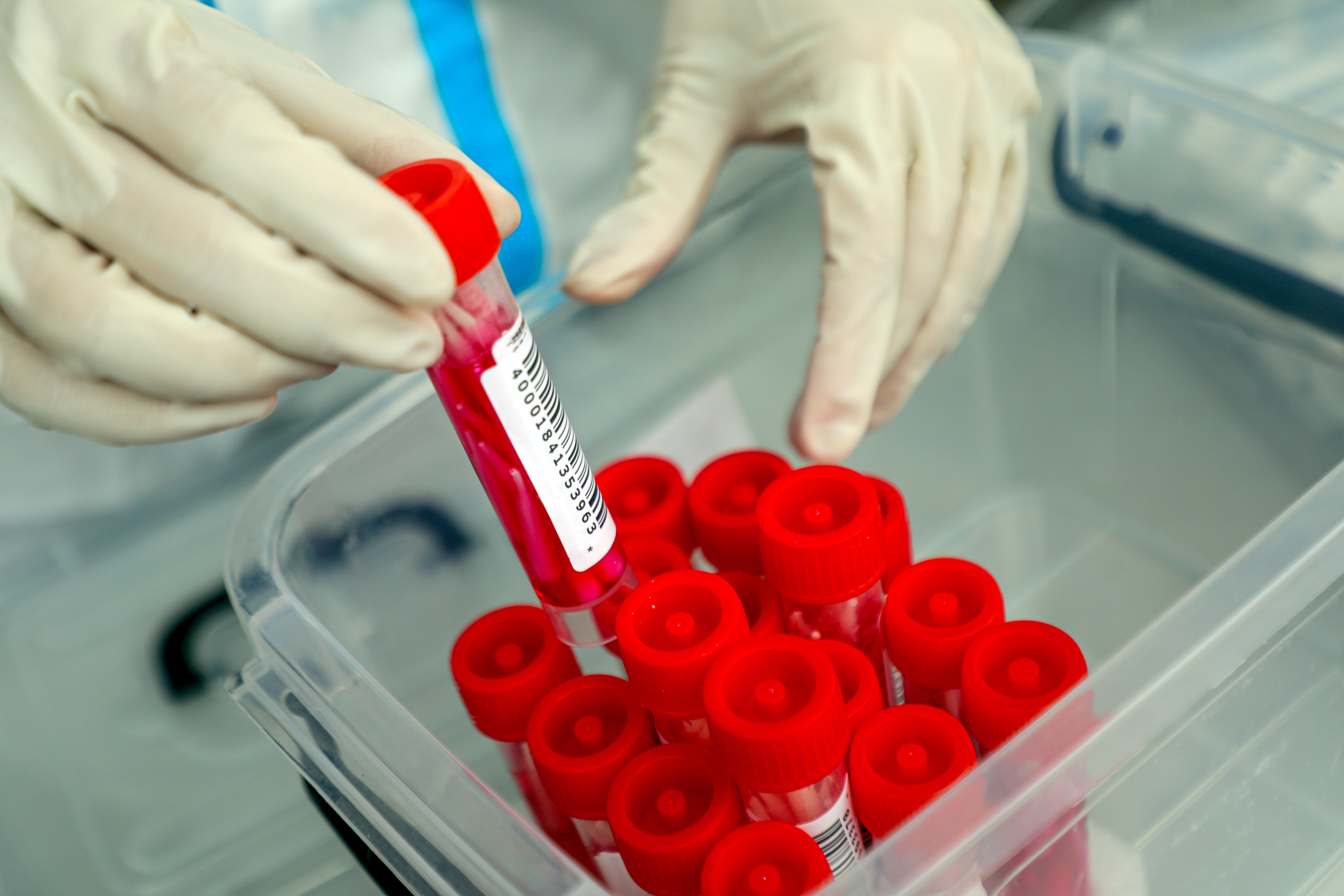 安彩高科：抗疫路上，從來都是“雙向奔赴”！